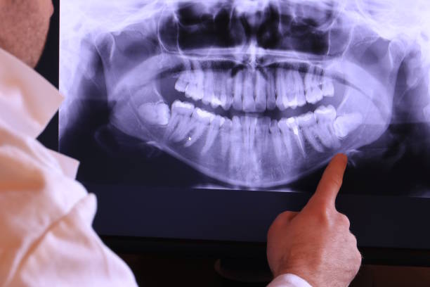 Best Emergency Tooth Extraction in Bloomsburg, PA